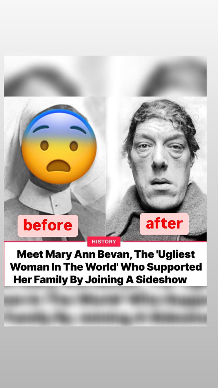 Mary Ann Bevan: The Heartbreaking Story Behind The ‘World’s Ugliest Woman’