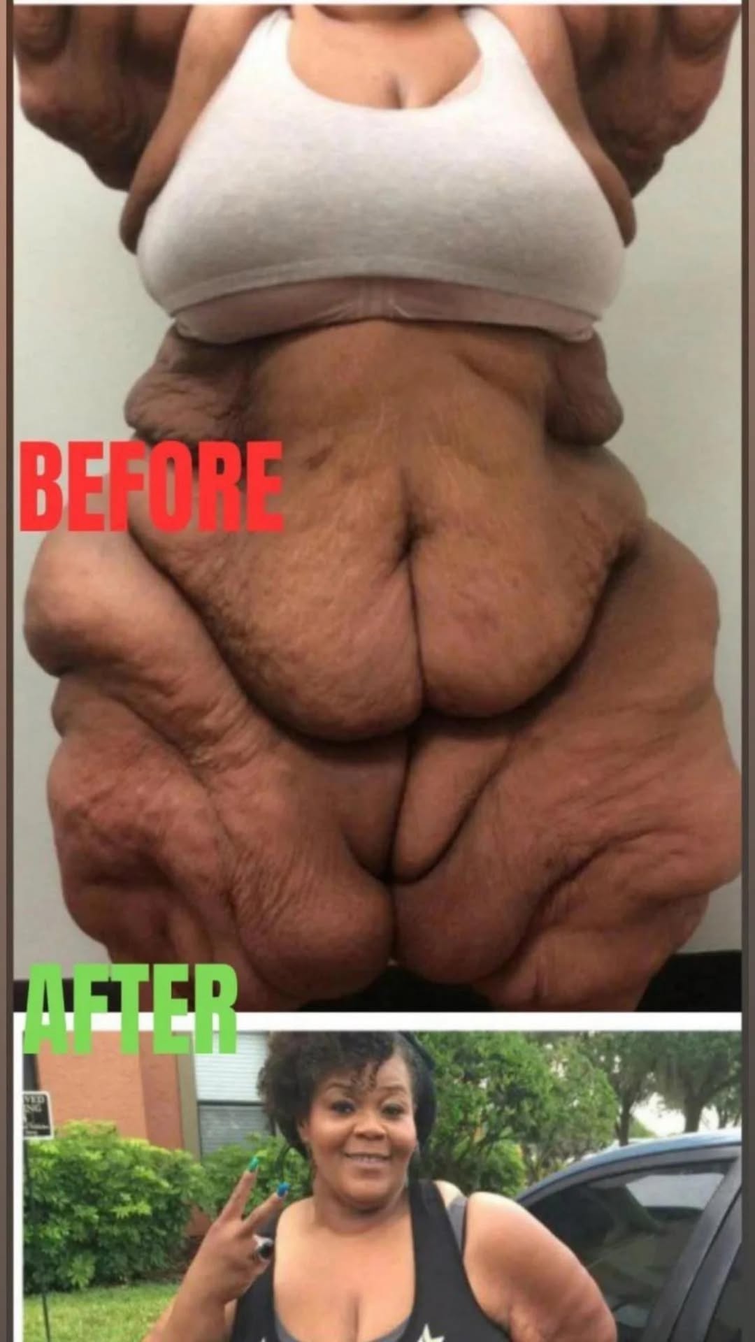 The world’s heaviest woman, who consumed a lot of milkshakes and weighed fifty stone, is no longer recognizable.