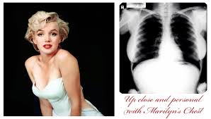 Marilyn Monroe Chest X-Rays Bring $45,000 at Auction