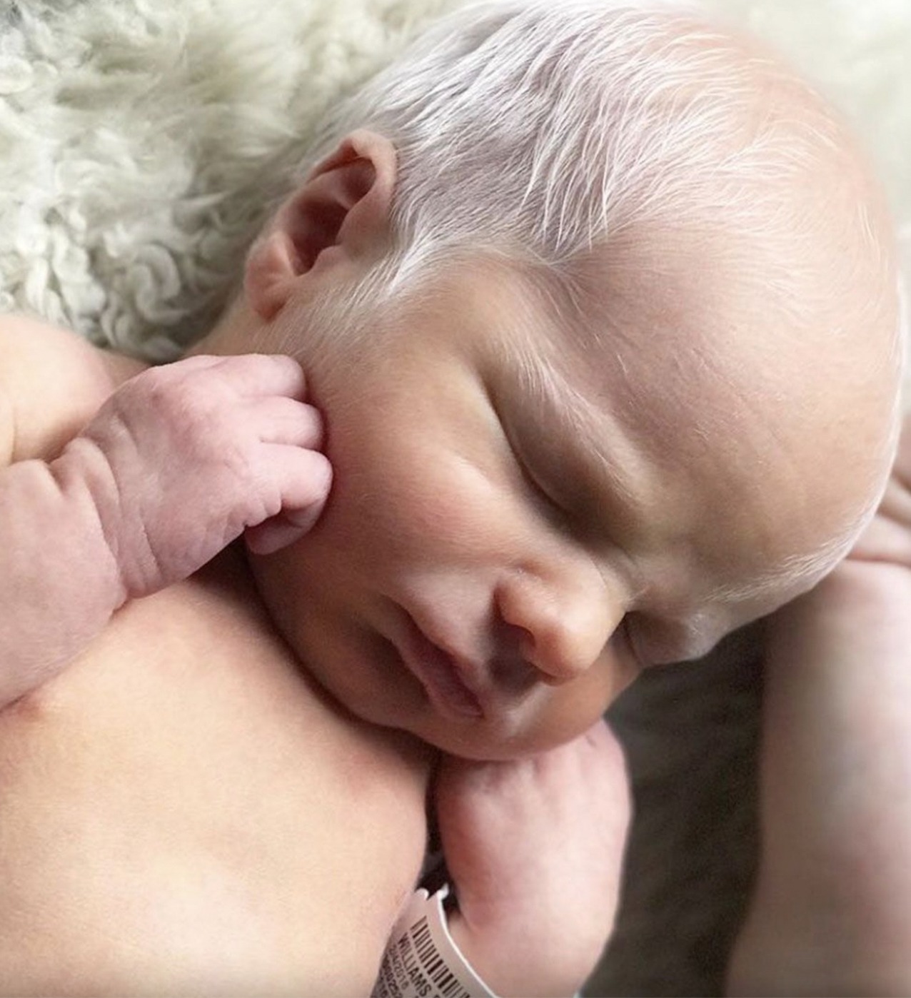 Albino baby mocked for white hair is happy and healthy years later