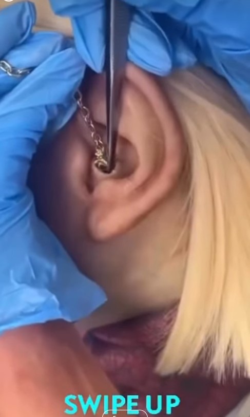 Ear Care to Prevent Infections
