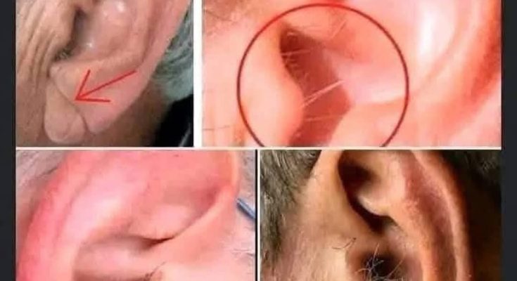 DID YOU KNOW that if hair grows on your ears, it’s because your body is…. Read more