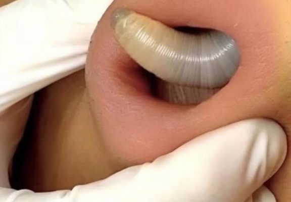 8 Important Body Symptoms You Should Never Ignore