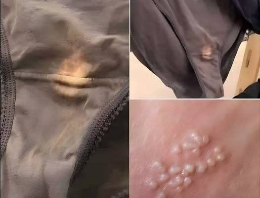 Warning Signs? These Mysterious Skin Dots Could Point to Something Serious — Find Out More